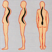 Prevención y rehabilitación